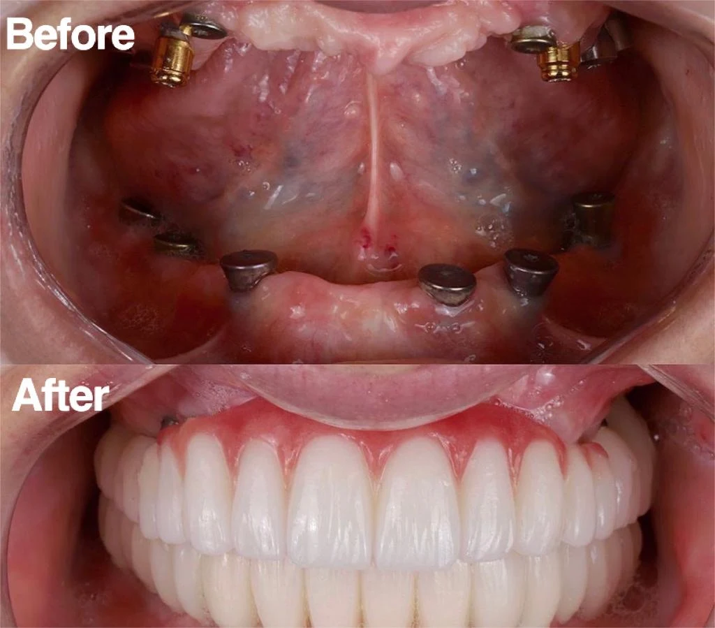 Dental care process at Dr Ankita's Dental Hospital